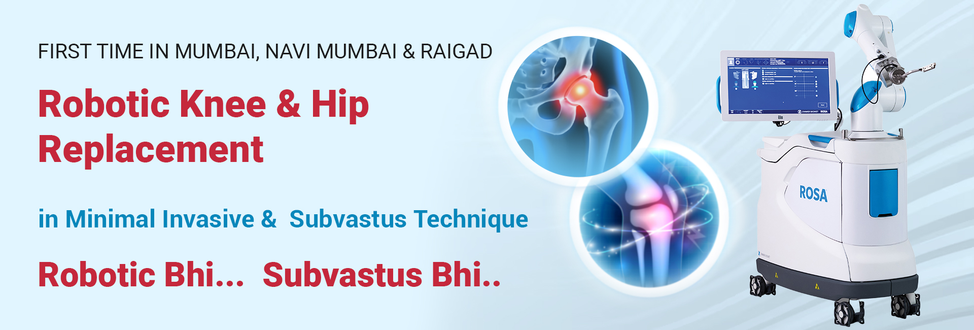 Robotic Knee Replacement Surgery in Navi Mumbai -  Rosaplasty - ROSA® Knee System is a Robotic Advancements In Total Knee Replacement to assist surgeon in customizing the precise placement of your knee implant to fit your needs.