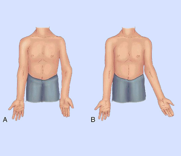 Dr. Kunal Makhija, orthopedic surgeon in Panvel, Navi Mumbai, specializes in Rosaplasty - Painless/Bloodless Subvastus Knee Replacement Surgery at Patel Clinic.